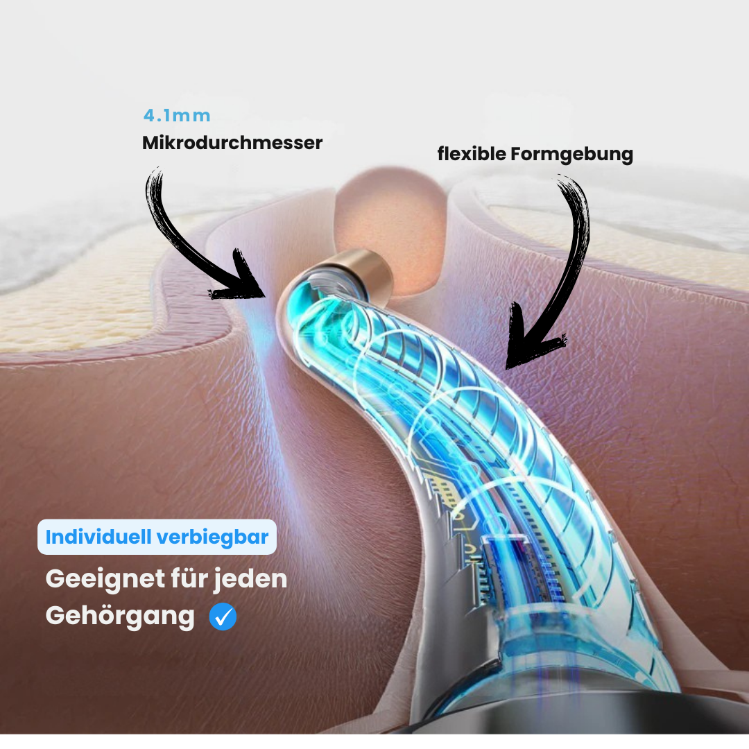EarScope Pro X Bebird